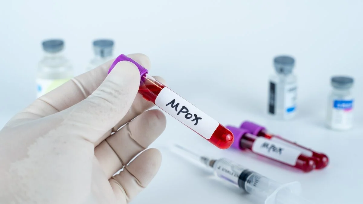 113 fioles contenant le virus Mpox dans les bagages ? Non, l